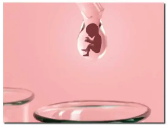 TESA and PESA Procedures at iCon IVF Center, Nandyal A doctor performing TESA or PESA